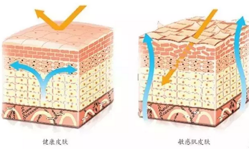 敏感肌膚與健康肌膚的對比，導(dǎo)致肌膚敏感的原因有哪些