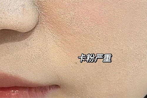 卡粉是什么意思？卡粉是什么原因引起的？