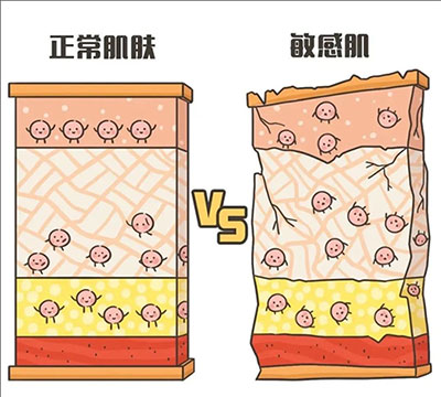 敏感性皮膚產(chǎn)生的原因是什么？