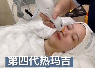 熱瑪吉的效果可以維持多久？熱瑪吉的效果可以保持一年嗎？